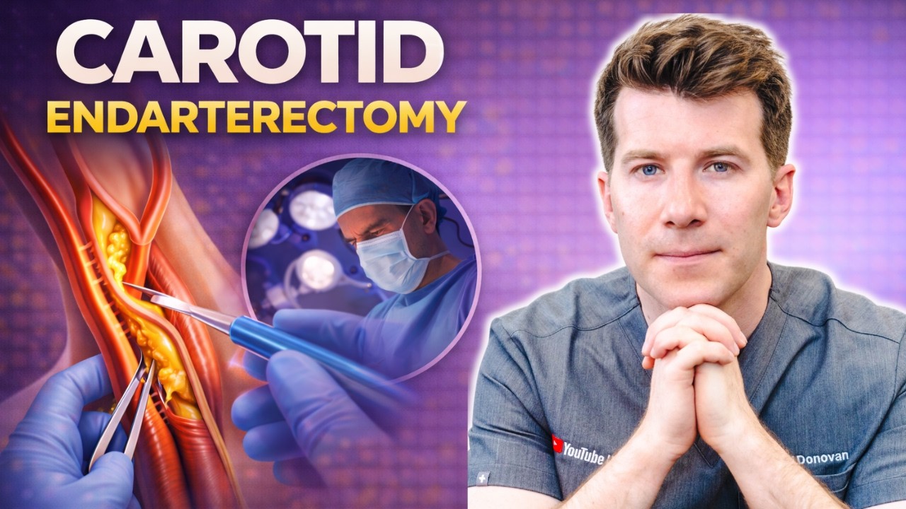 Doctor explains Carotid Endarterectomy | Procedure, benefits, risks and recovery