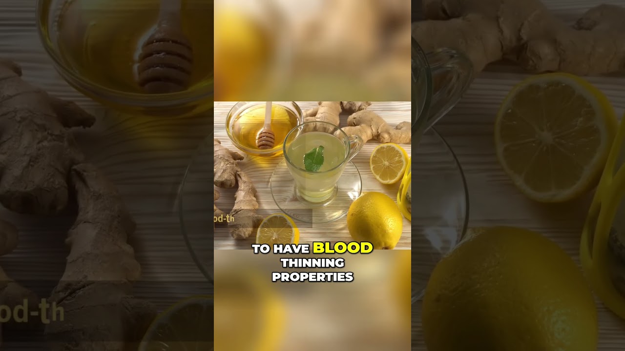 Ginger and Bleeding Disorders  Cautionary Dietary Considerations 