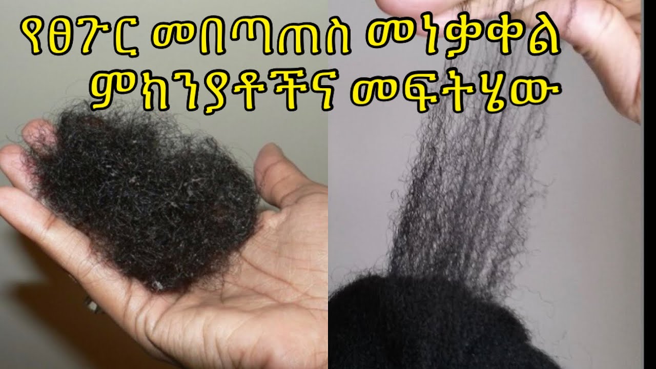 📌የፀጉር መበጣጠስ መነቃቀል ለማቆም ምክንያቱና መፍትሄው// how to stop hair breakage