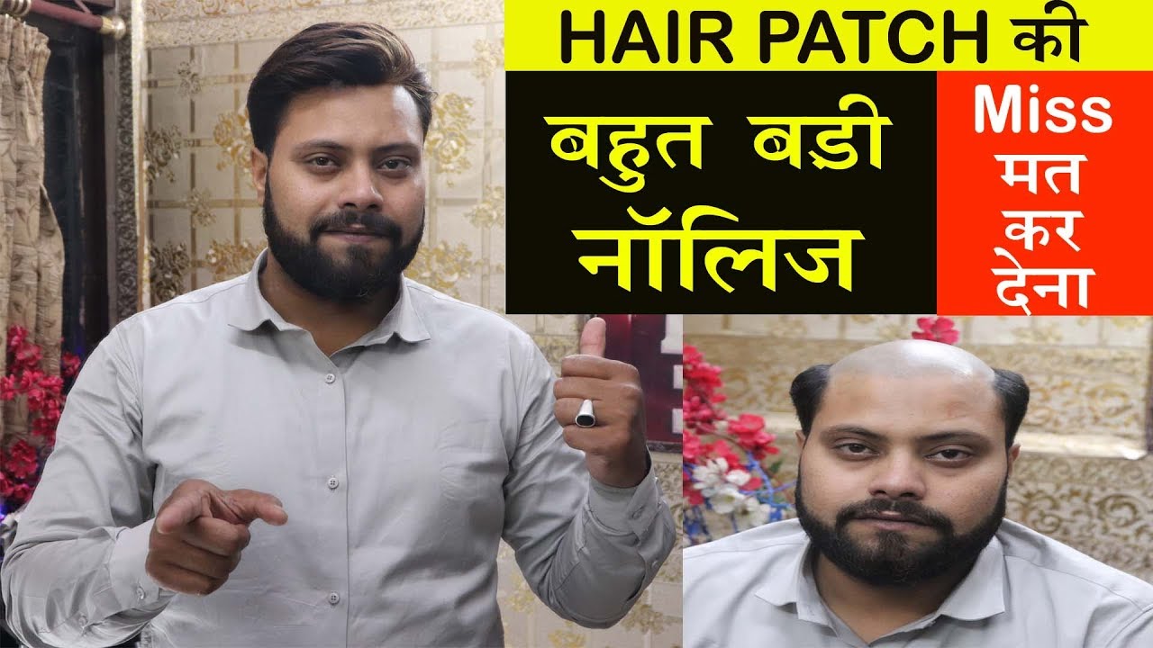 Amazing  knowledge | in hair patch system | by delhi hair fixing | call us – 9873152223