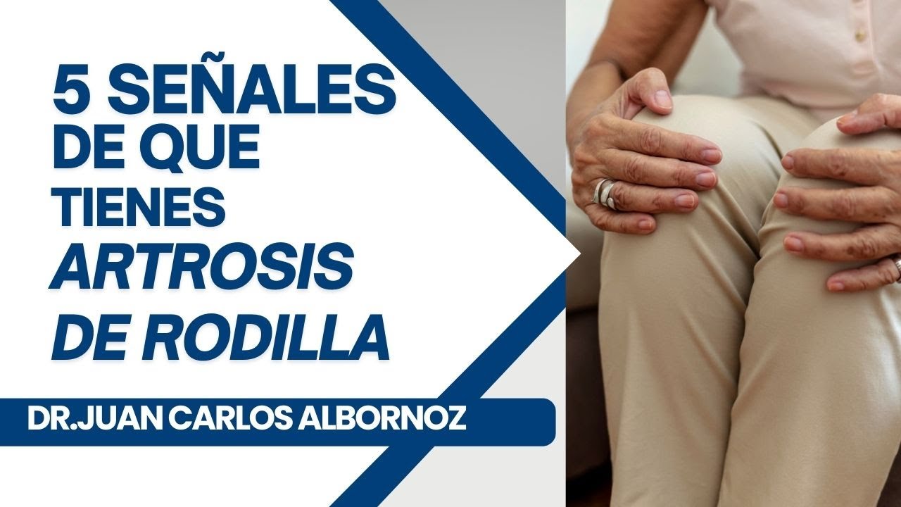 5 SE&Ntilde;ALES DE QUE TIENES ARTROSIS DE RODILLA, Y LA &Uacute;LTIMA ES LA M&Aacute;S GRAVE    #artrosisderodilla