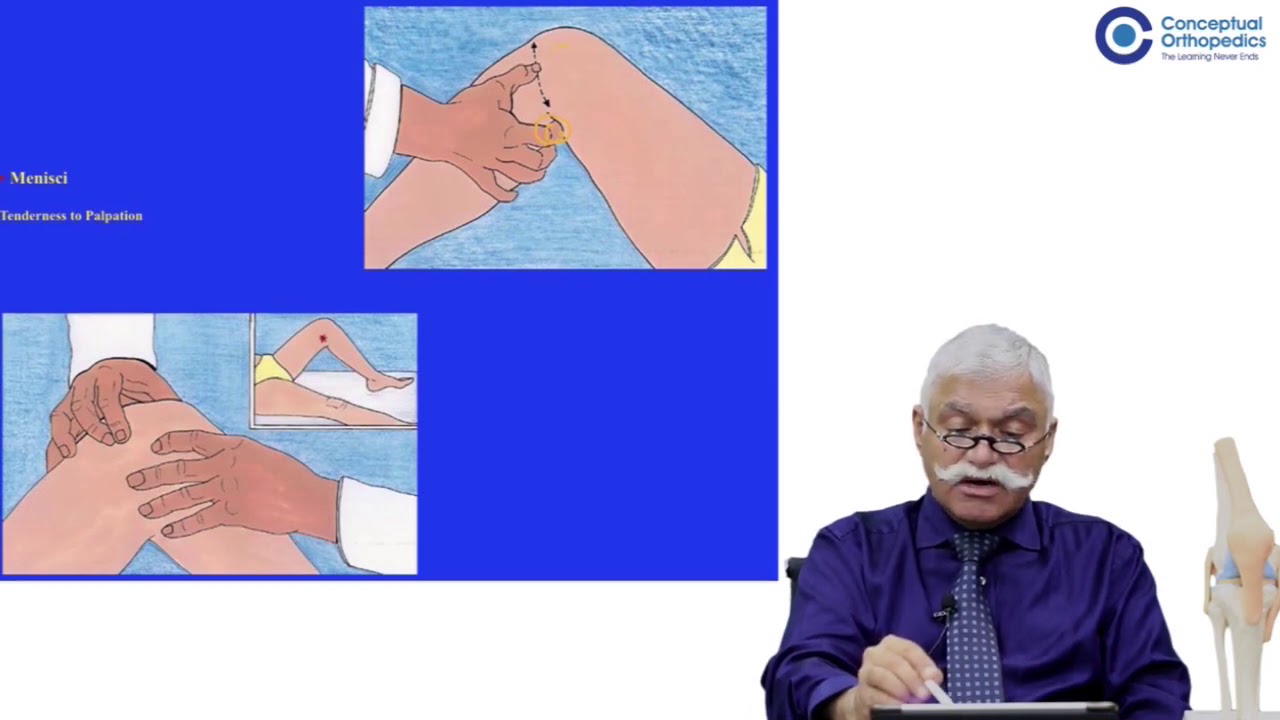 History and Examination of Knee Joint - Conceptual Orthopedics