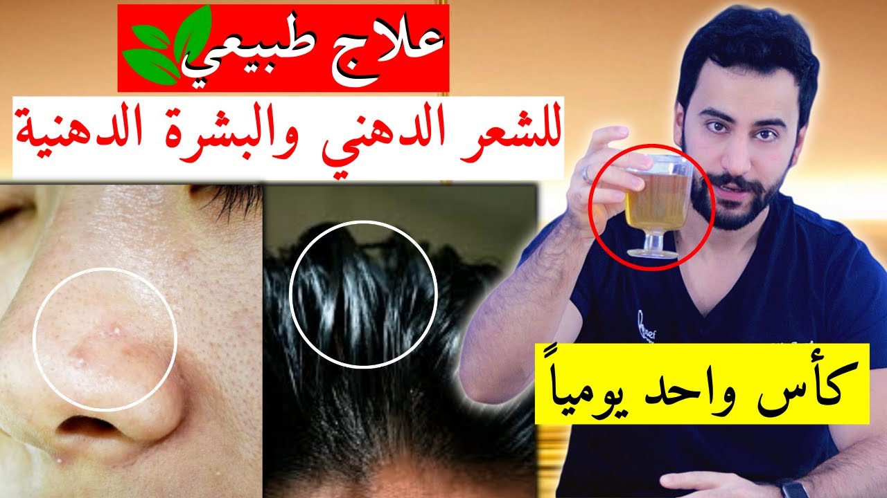 العلاج الطبيعي الأقوى والأساسي للبشرة الزيتية والشعر الزيتي | دكتور يوسف