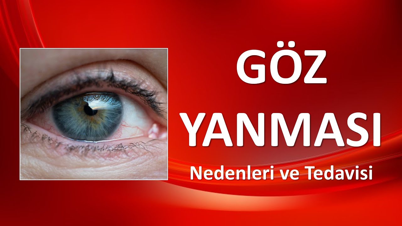 GÖZ YANMASI Nedenleri ve Tedavisi