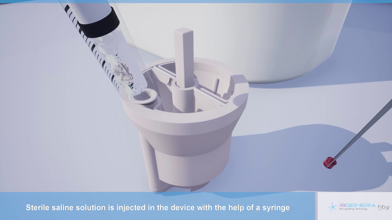 Rigenera HBW - Lipofilling