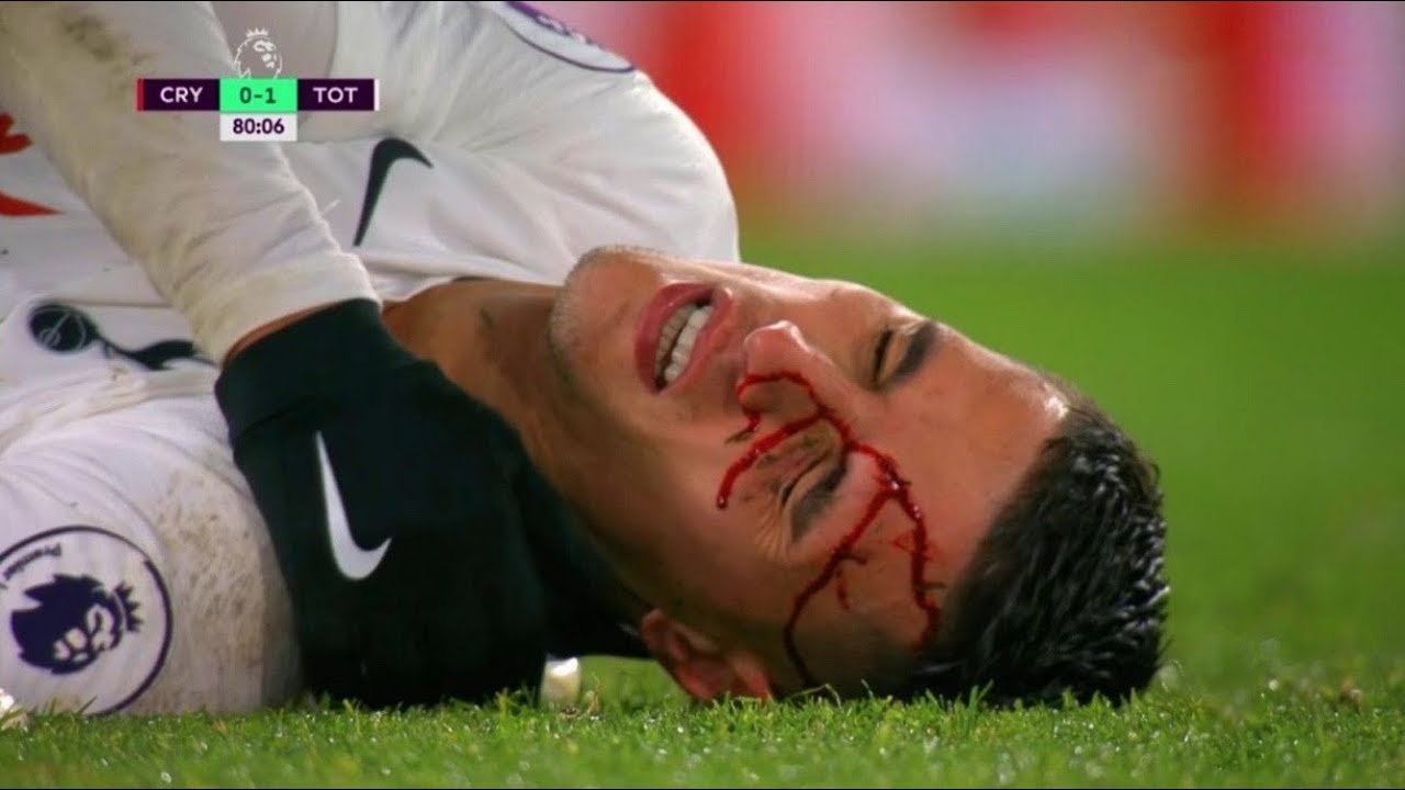 THE MOST DISGRACEFUL FOOTBALL FOULS (is he alive?)