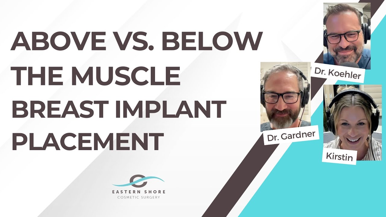 Above or Below the Muscle? The Truth About Breast Implant Placement