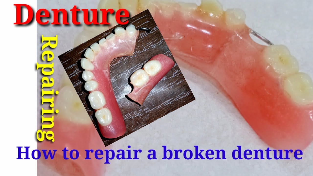 How to repair a broken denture in 20 minute | Repairing a broken denture | Haider art & idea, dental