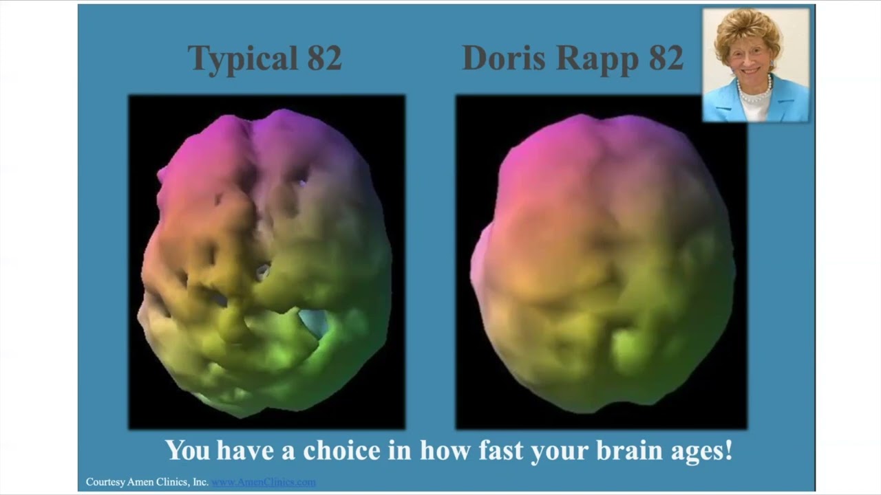 Anti-Aging Tips For A Youthful Brain
