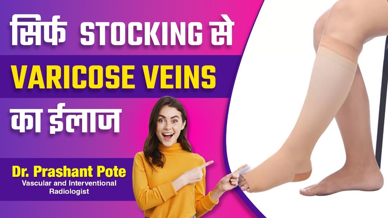 Varicose Veins Care: How to Choose and Use Stockings Complete Guide by Dr. Prashant Pote