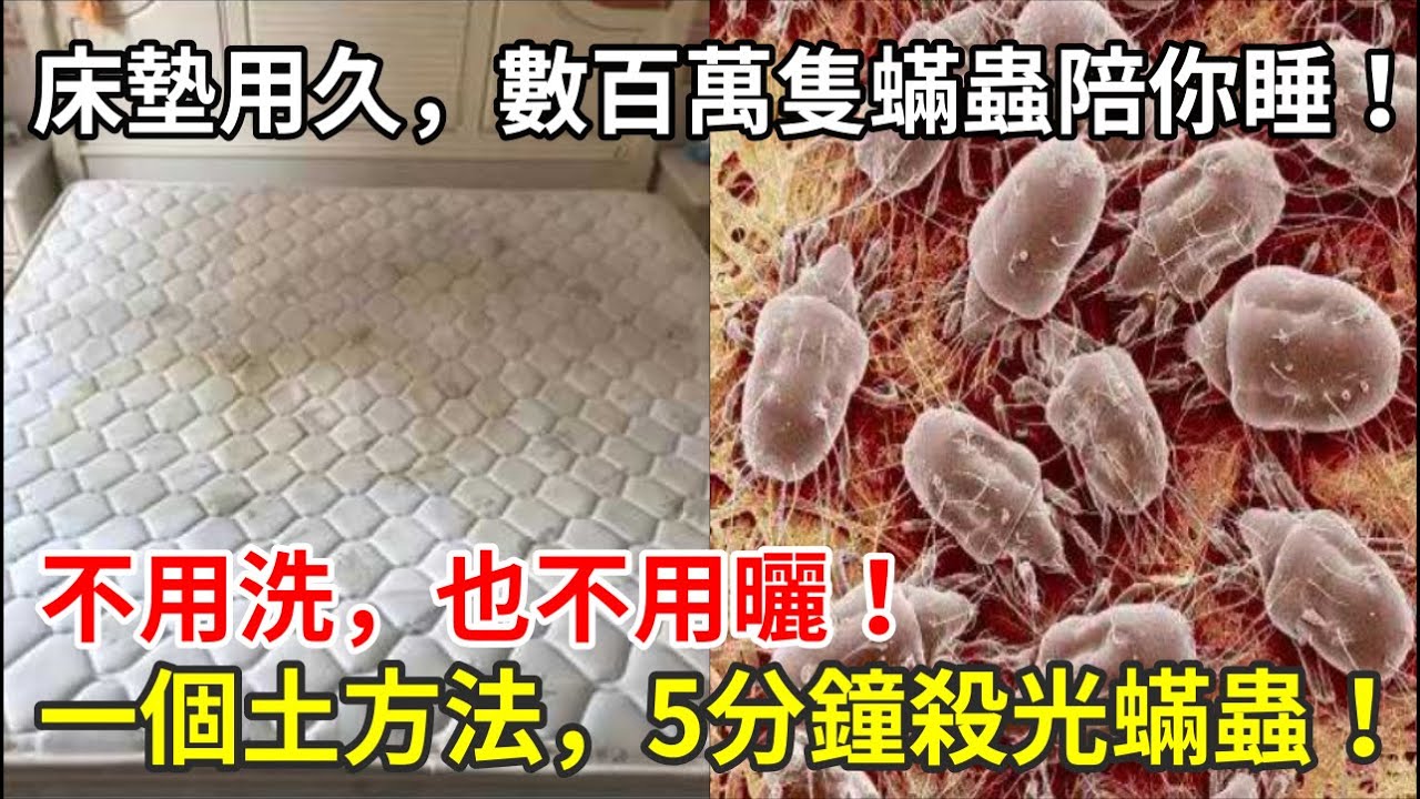 床墊用久了，數百萬隻蟎蟲陪你睡！用一個土方法，5分鐘殺光蟎蟲！不用洗，也不用曬！