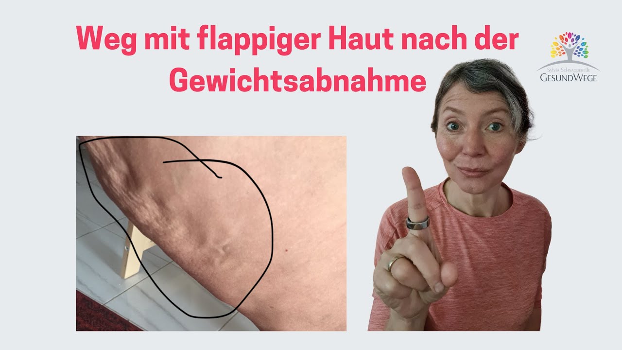 Weg mit schlaffer Haut nach Gewichtsreduktion