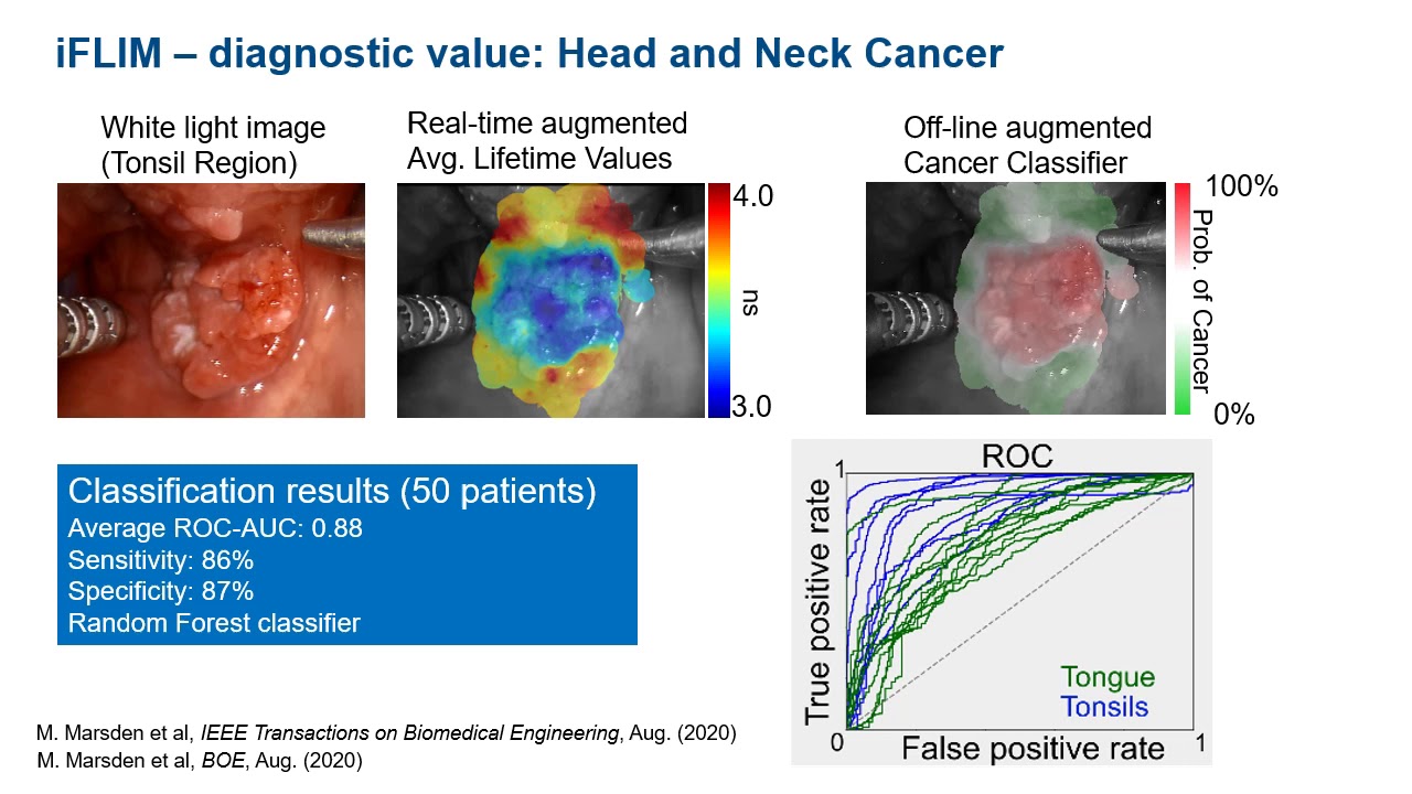 Laura Marcu - Intra-procedural Fluorescence Lifetime Imaging (iFLIM)