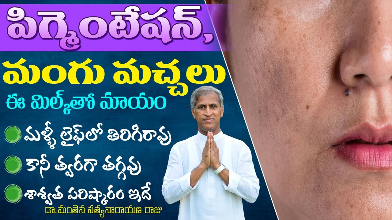 Home Remedies for Pigmentation : How to Remove Mangu Machalu | Dr Manthena Satyanarayana Raju Videos