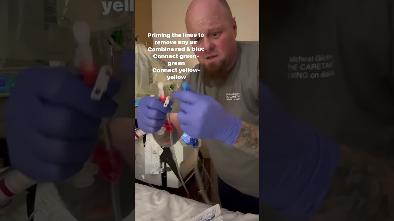 Priming and connecting lines for treatment with nxstage