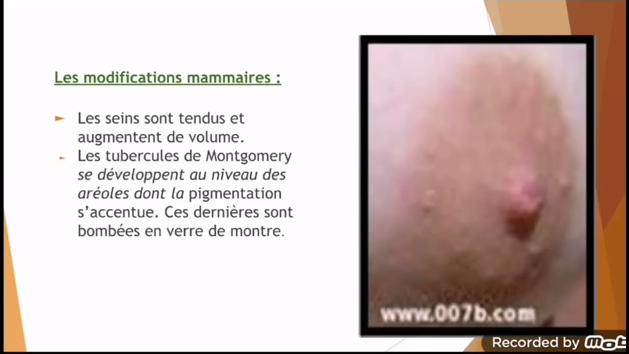Diagnostic et suivi de grossesse #gynéco