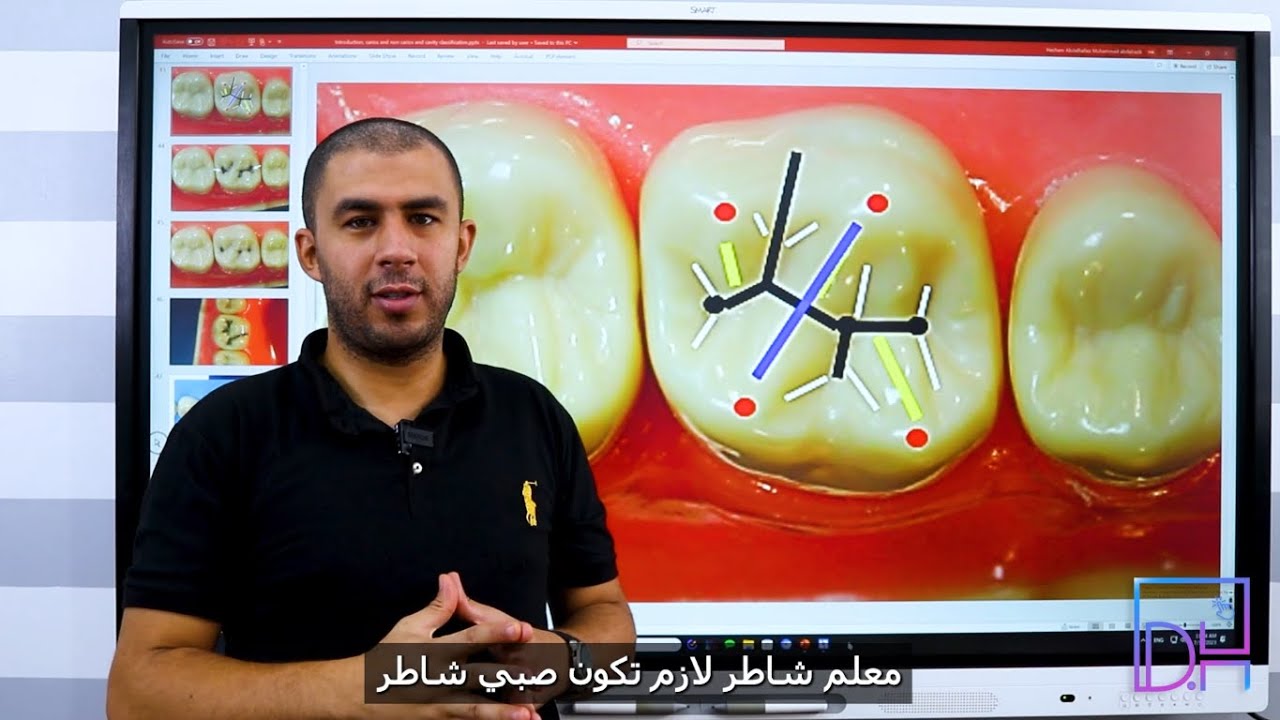انزل اتدرب في عيادة أسنان ولا لأ ؟ الدليل الشامل 