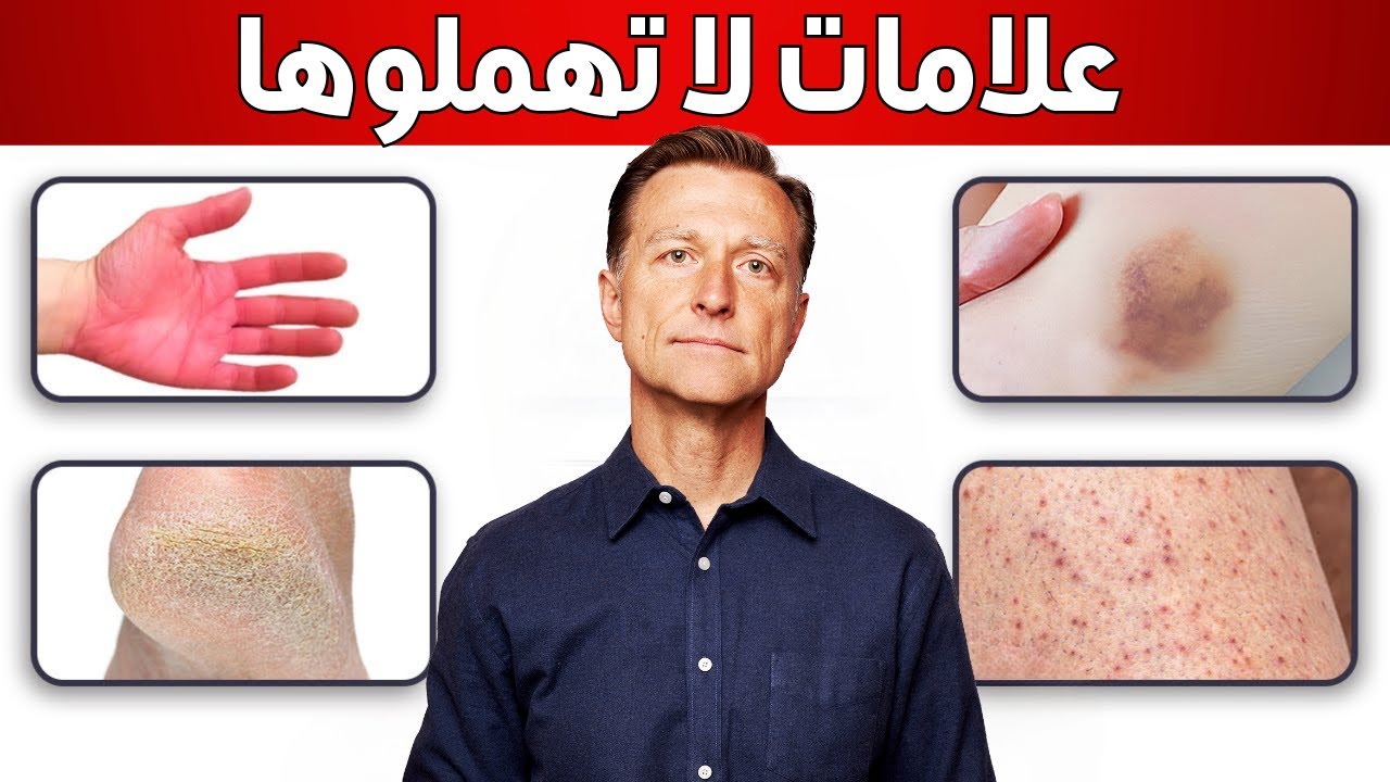 علامات الجلد التي تخبرك بزيادة المعادن الثقيلة في جسمك📣