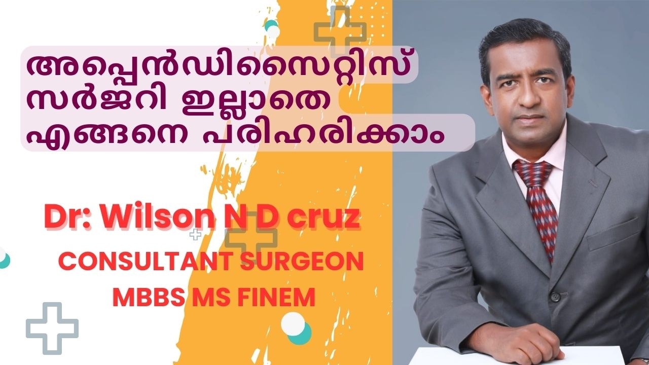 അപ്പെൻഡിസൈറ്റീസ് സർജറി ഇല്ലാതെ എങ്ങനെ പരിഹരിക്കാം Dr wilson N D Cruz Consultant Surgeon