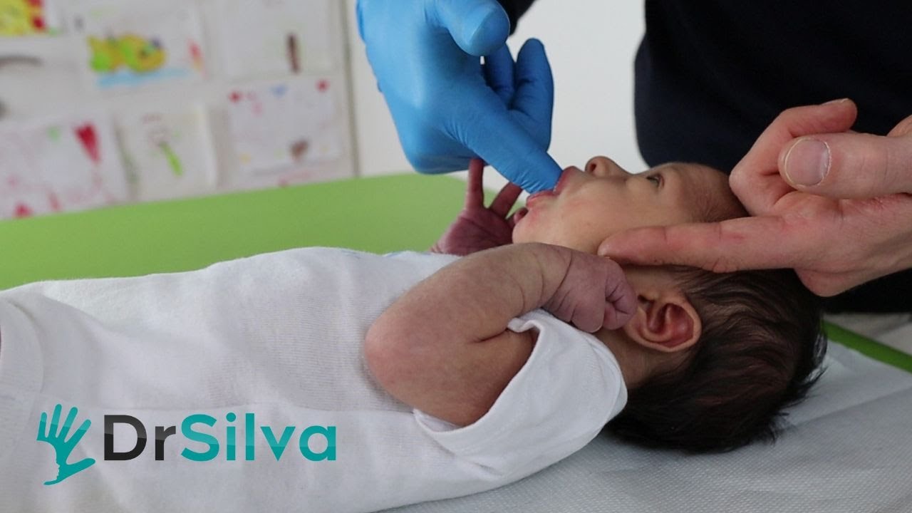 PROBLEMI DI SUZIONE E ALLATTAMENTO AL SENO - COME RISOLVERLI COL SUPPORTO DI OSTESTRICA E OSTEOPATA