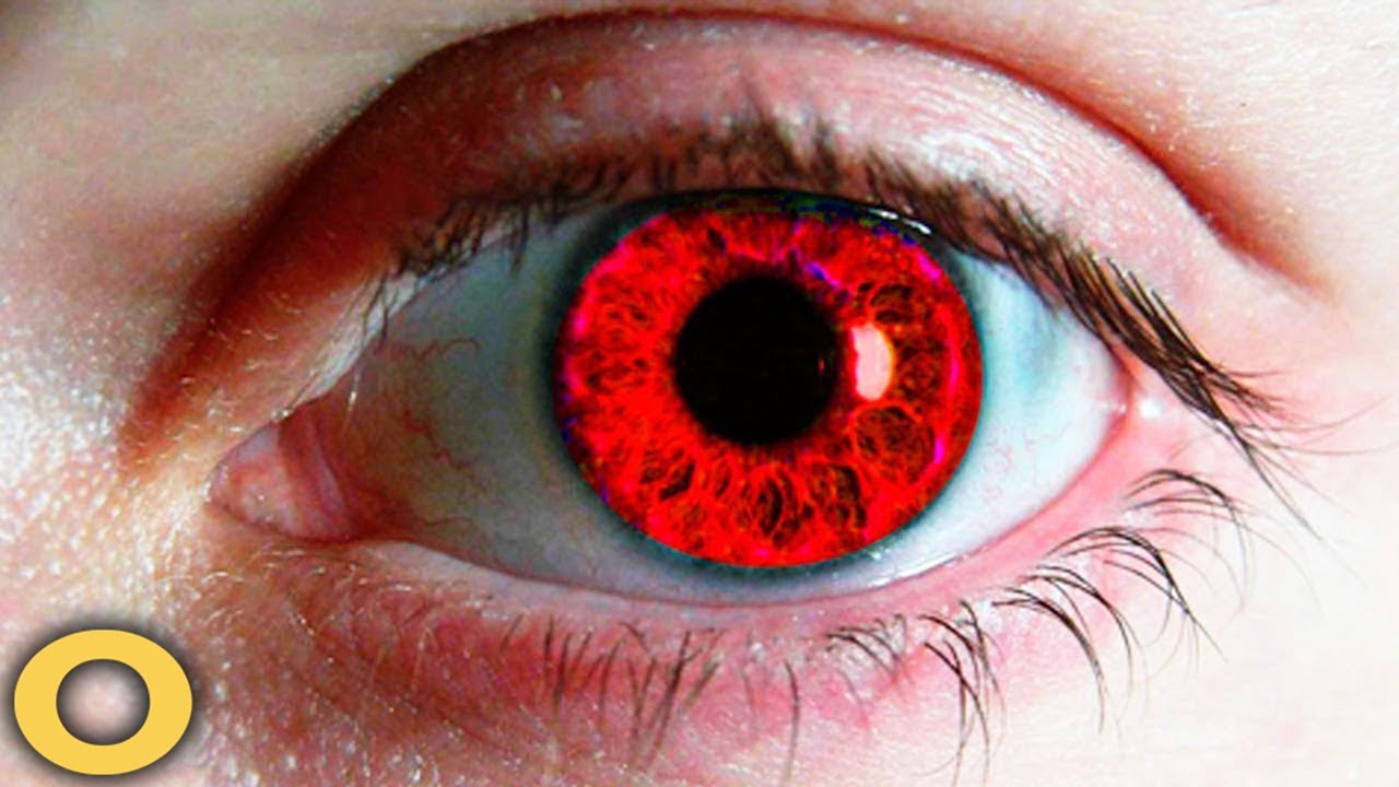 10 Kids With Rare Eyes Who Are One in a Million