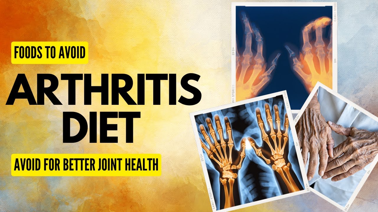 Arthritis Diet: 9 Foods to Avoid for Better Joint Health