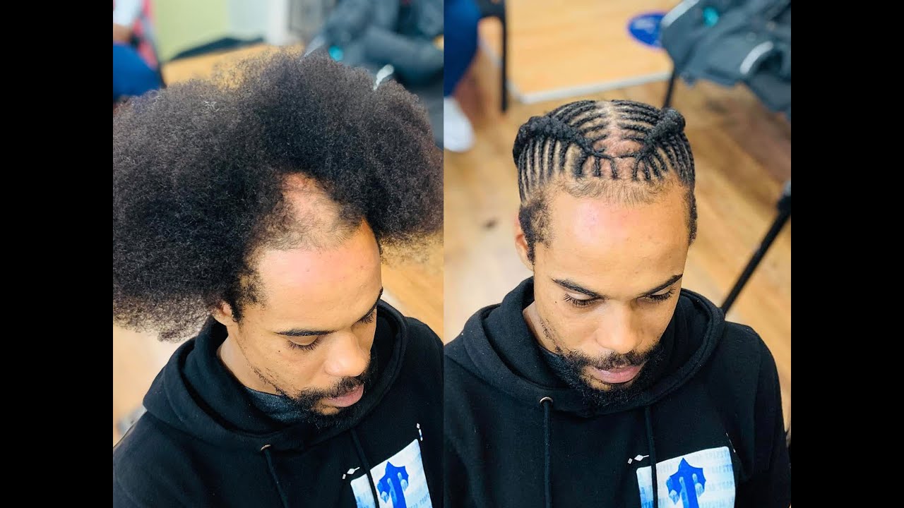 HOW TO BRAID OVER BALD PATCHES FOR BEGINNERS 🔝