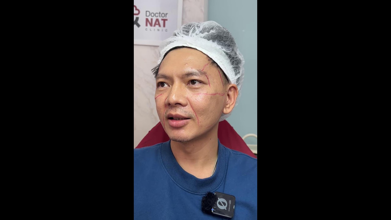 รักษาหลุมไป 5 ปี ฟูดีไม่มียุบ