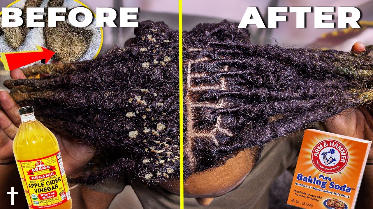 HOW TO ACV RINSE YOUR DREADLOCKS | Step By Step Tutorial