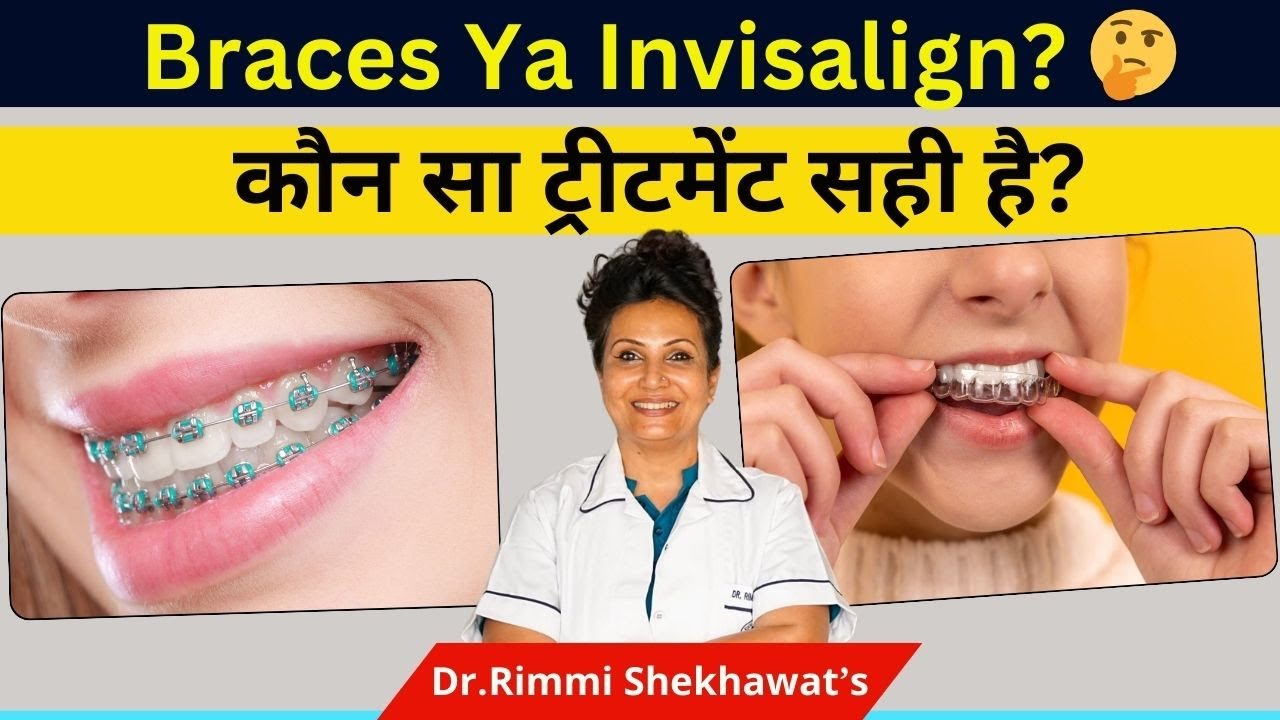 Teenagers vs Adults 🤔 Braces Ya Invisalign? | Kaunsa Best Hai Aapke Liye?