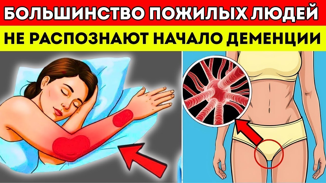 После 60 8 Ранних Признаков Сосудистой Деменции (Большинство Людей Пропускают №3)