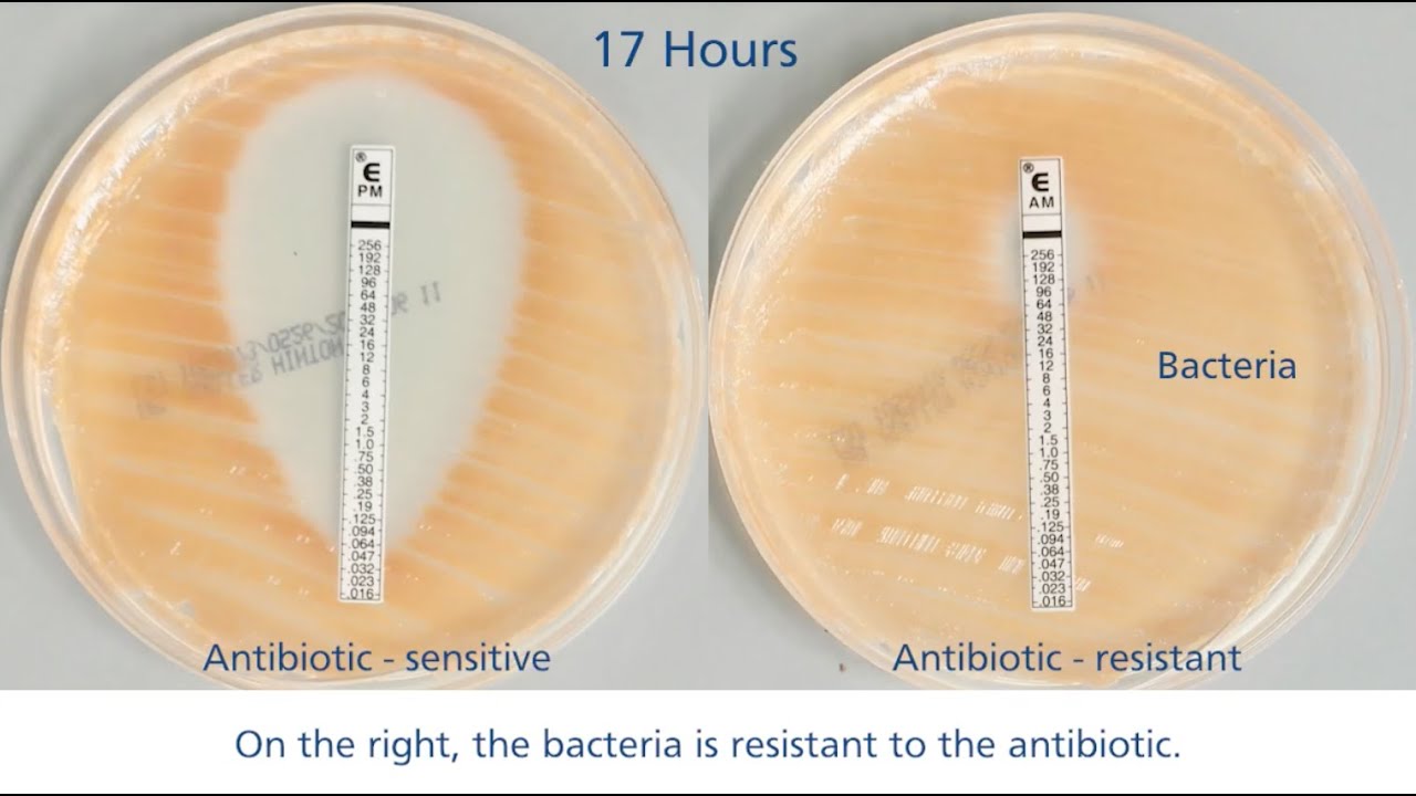 What happens if you misuse antibiotics?