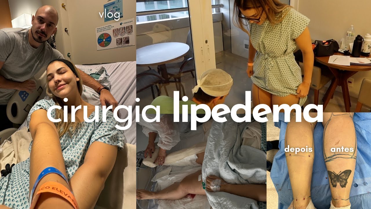 VLOG DA CIRURGIA DO LIPEDEMA |  GRAVAMOS TUDO NO HOSPITAL, PRIMEIRO DIA EM CASA