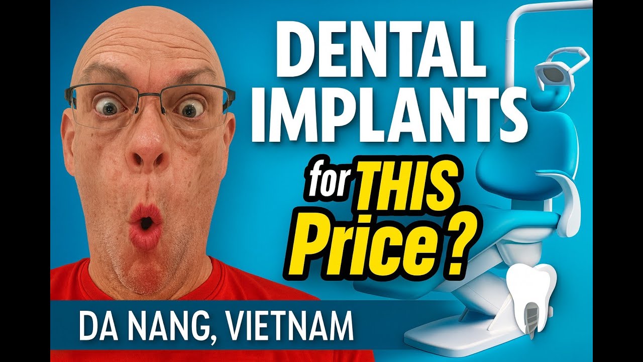 Dental implants and veneers at Valis Dental Danang.