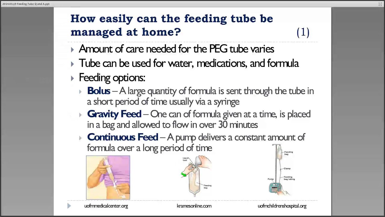 Feeding Tubes  Questions and Answers