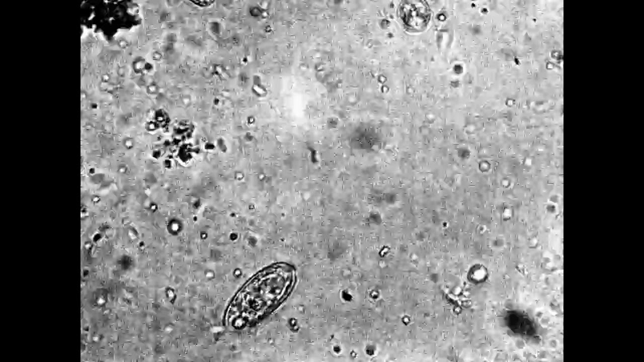The Life in a Floating Biofilm