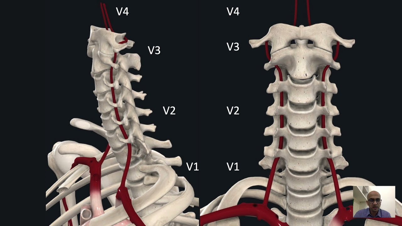 Tracking Vertebral Artery - Safe Anatomical Corridors