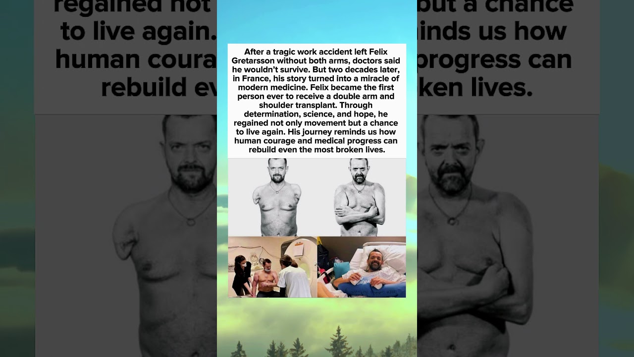 Felix Gretarsson: The Man Who Regained His Arms After 20 Years | True Medical Miracle #shorts