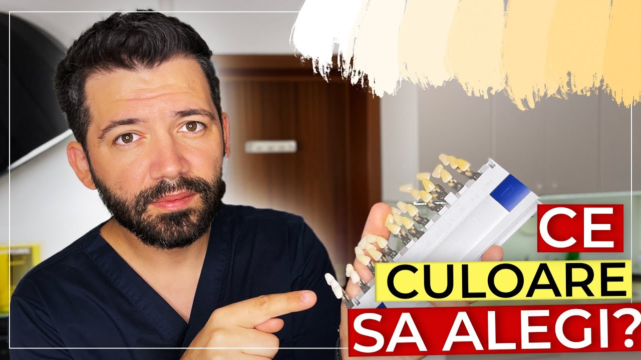 Fatete Dentare - Ce culoare sa alegi? (A1? B1? 0M1?)
