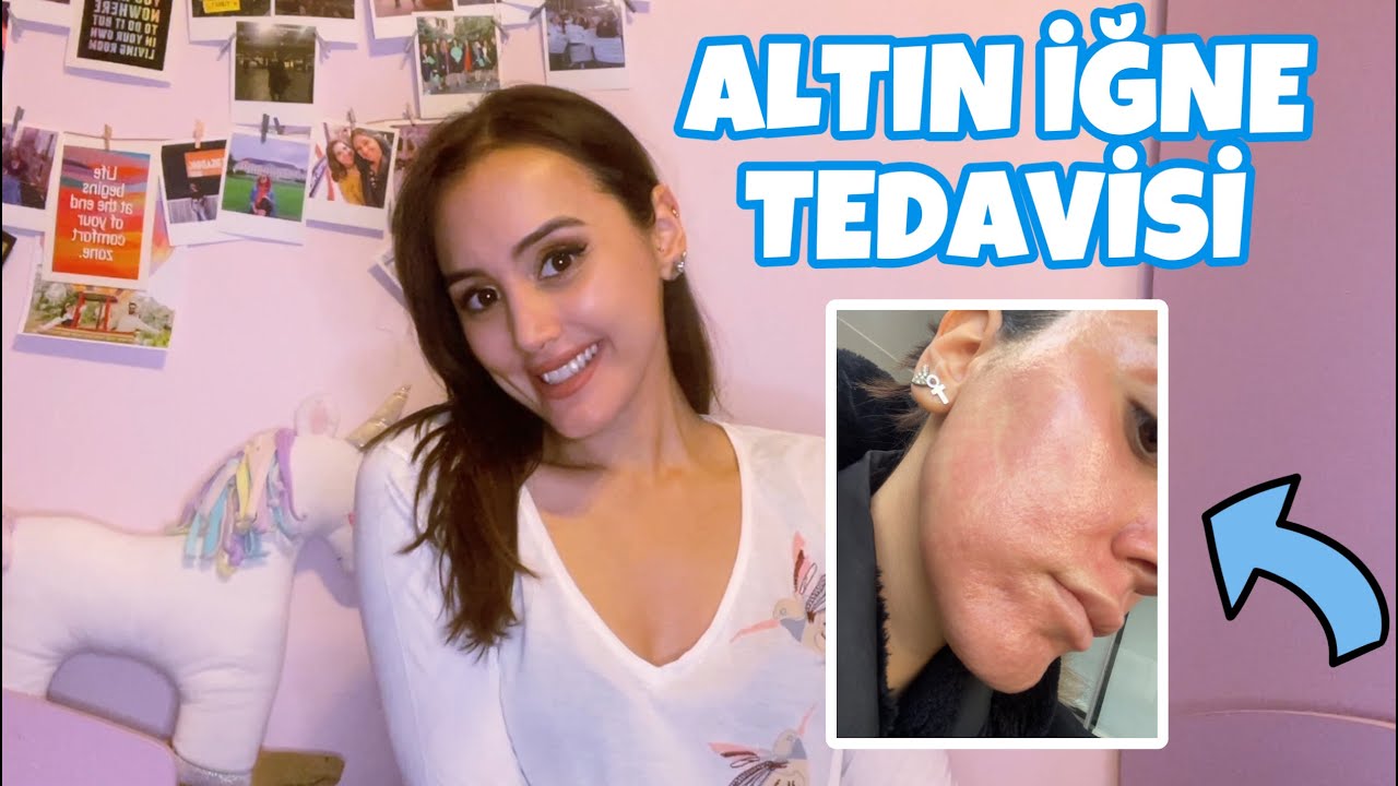 ALTIN İĞNE SÜRECİM / SİVİLCE VE AKNE İZİ TEDAVİSİ