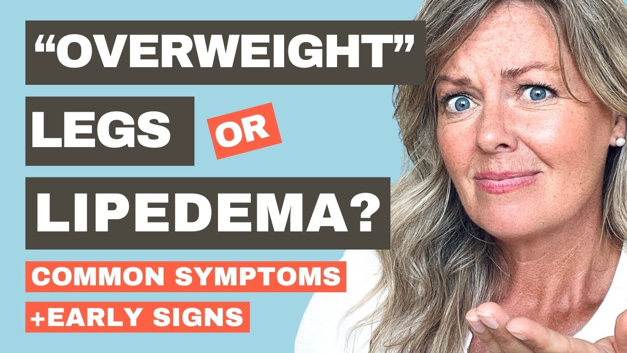 Common Symptoms and Signs of Lipedema (Legs Feeling Weird? Watch This!)