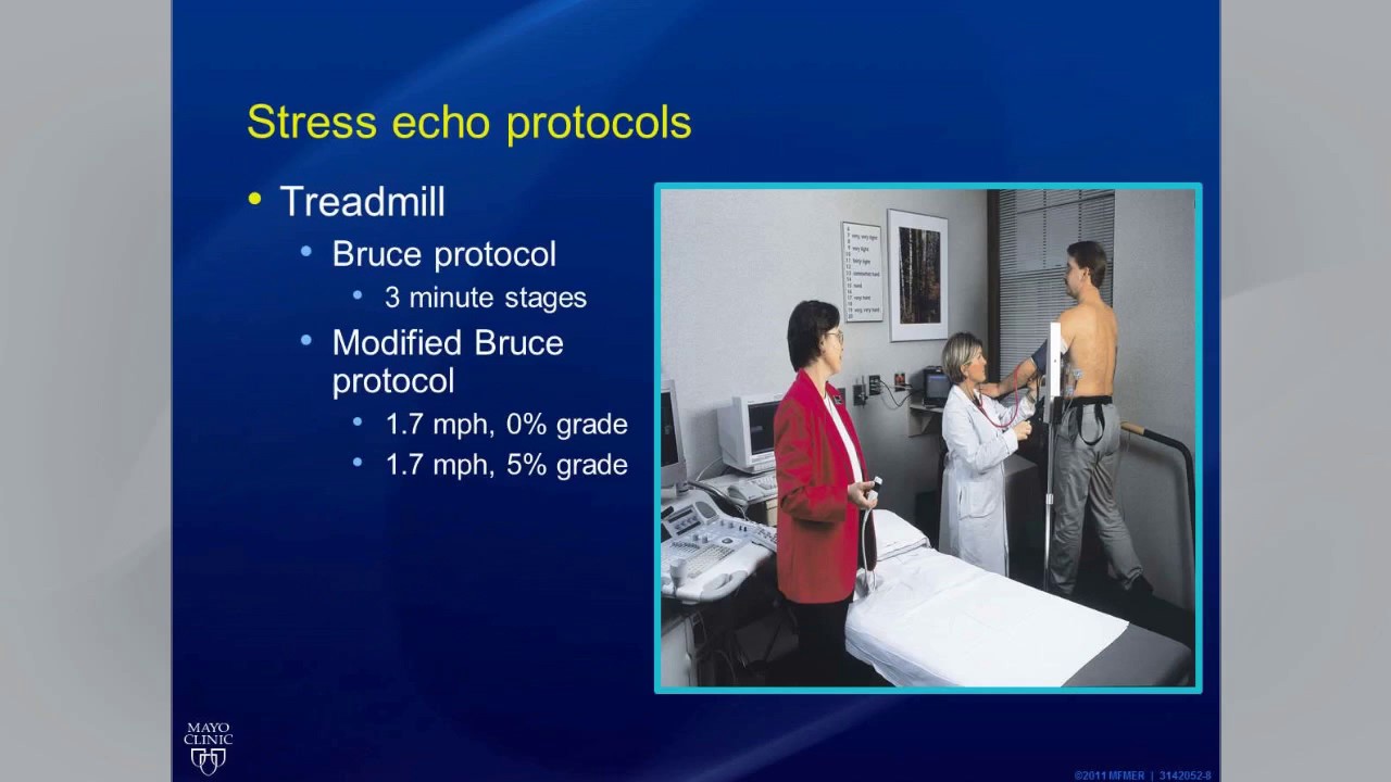 Clinical Use of Stress Echo in Nonischemic Heart Disease Webinar