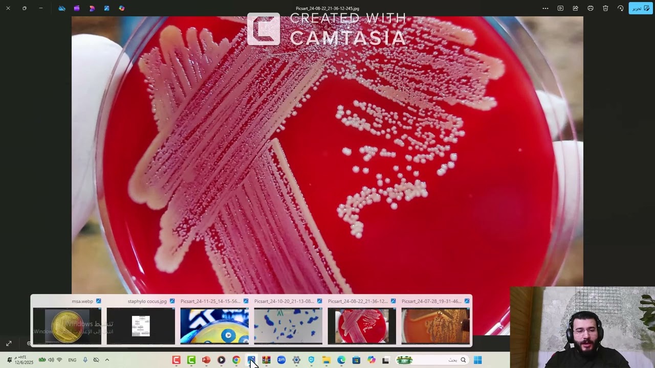 تشخيص Staphylococcus aureus في المختبر خطوة بخطو