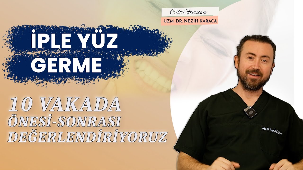 İple yüz Germe: 10 Kişide Öncesi Sonrası Sonuçların Değerlendirilmesi