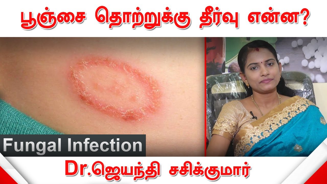 பூஞ்சை தொற்றுக்கு தீர்வு கூறுகிறார் மருத்துவர் ஜெயந்தி சசிக்குமார் | Fungal Infection | Health Tips