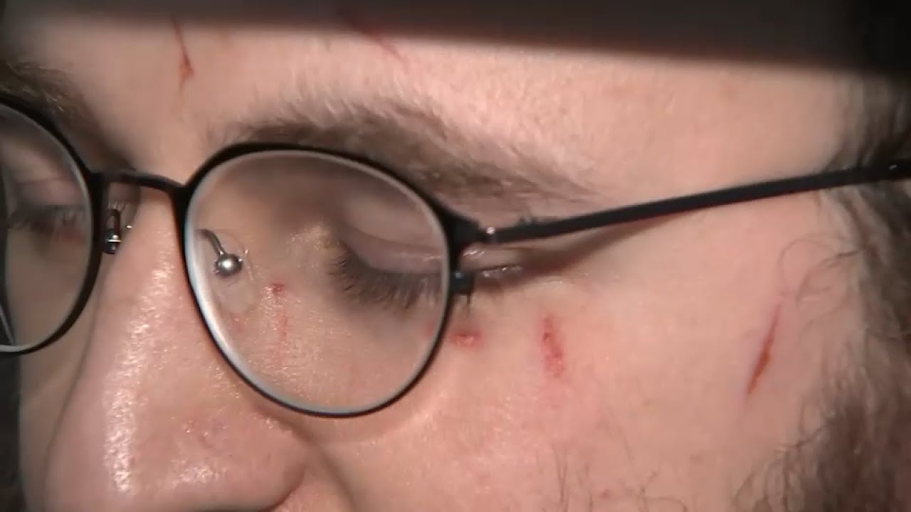 Man arrested after rabbi attacked on way to synagogue in Queens