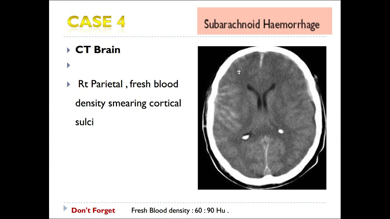 RADIOLOGY CASES REVISION - 5th year Medical Students  2021 - Dr  Ahmad Mokhtar Abodahab