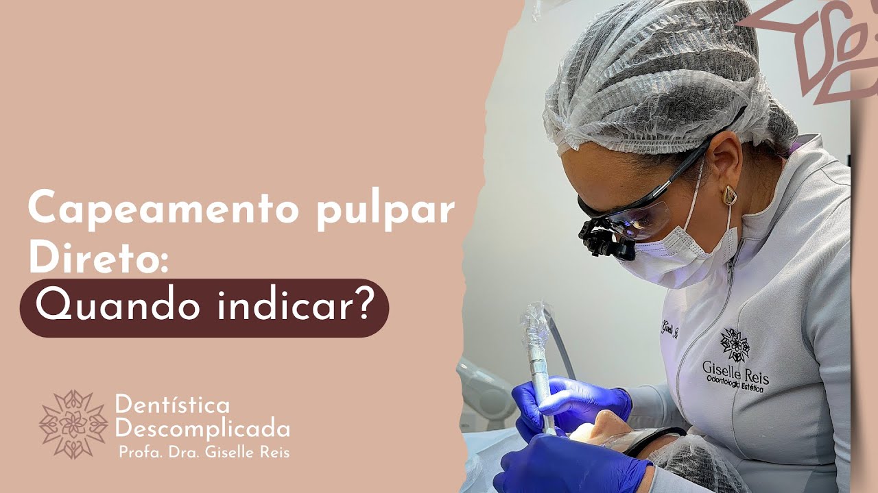 CAPEAMENTO PULPAR DIRETO: Quando Indicar? | Dentística Descomplicada