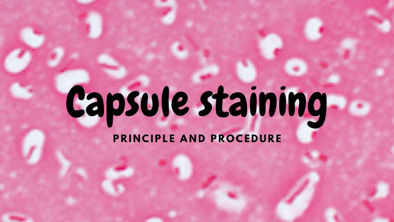 Capsule Staining- India ink method And  Anthony’s stain method