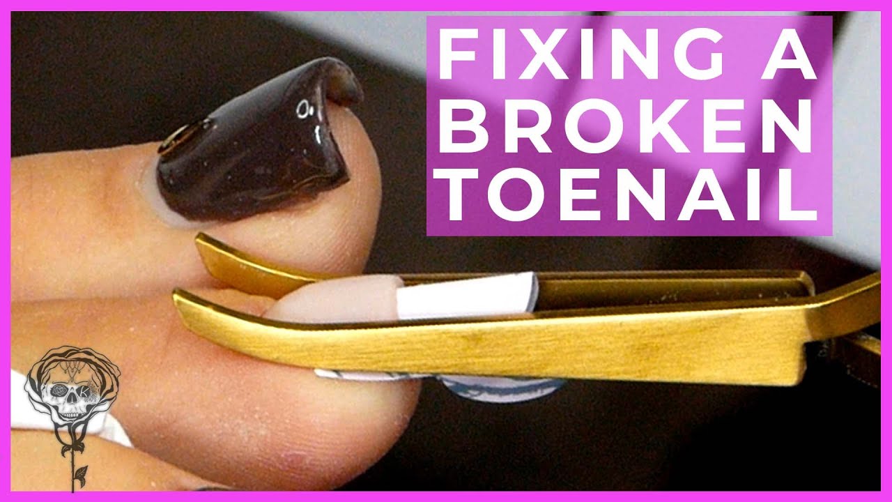 Fixing Fay's Gammy Toe with the Tiniest Ever Sculpting Form!